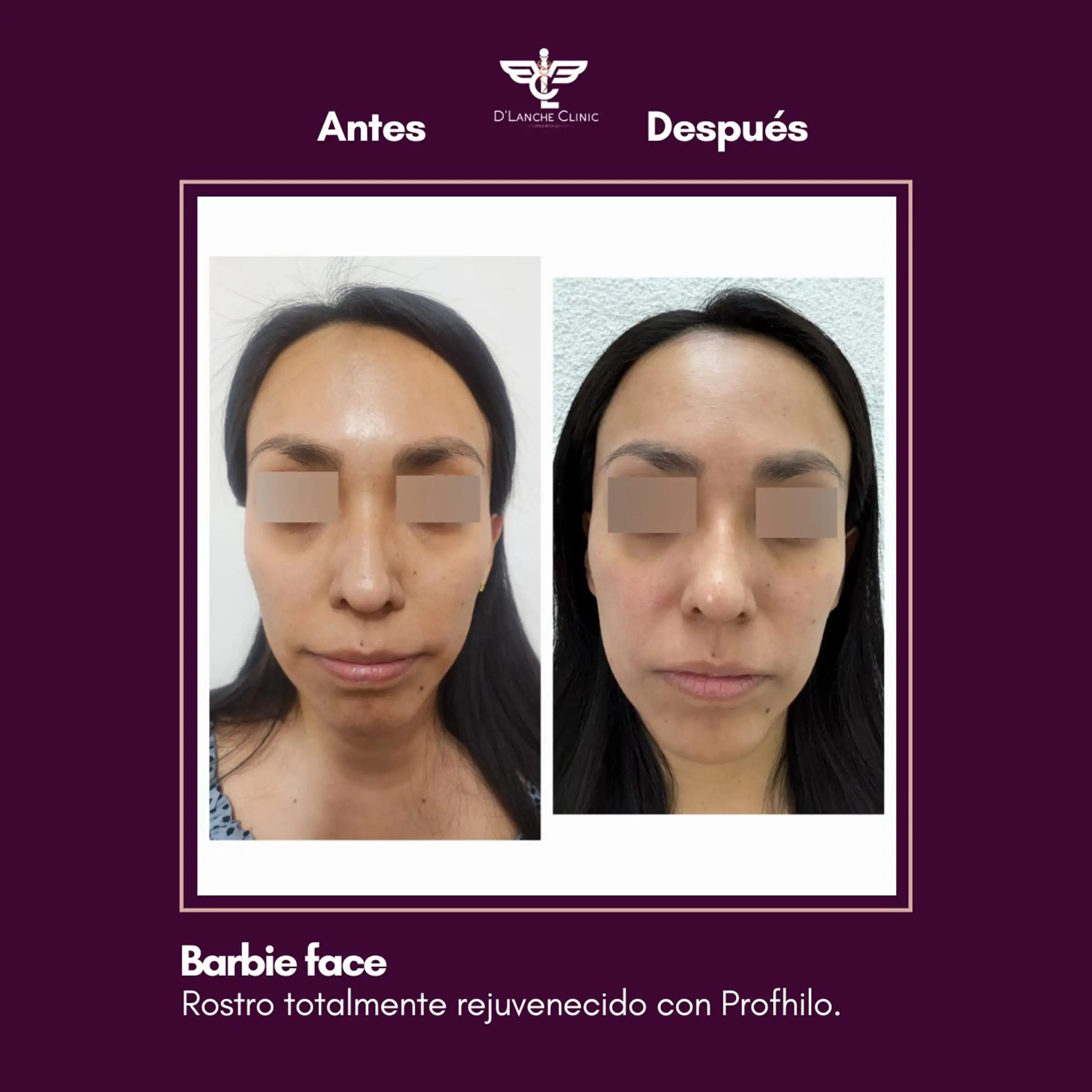 1 Resultados - DLanche Clinic