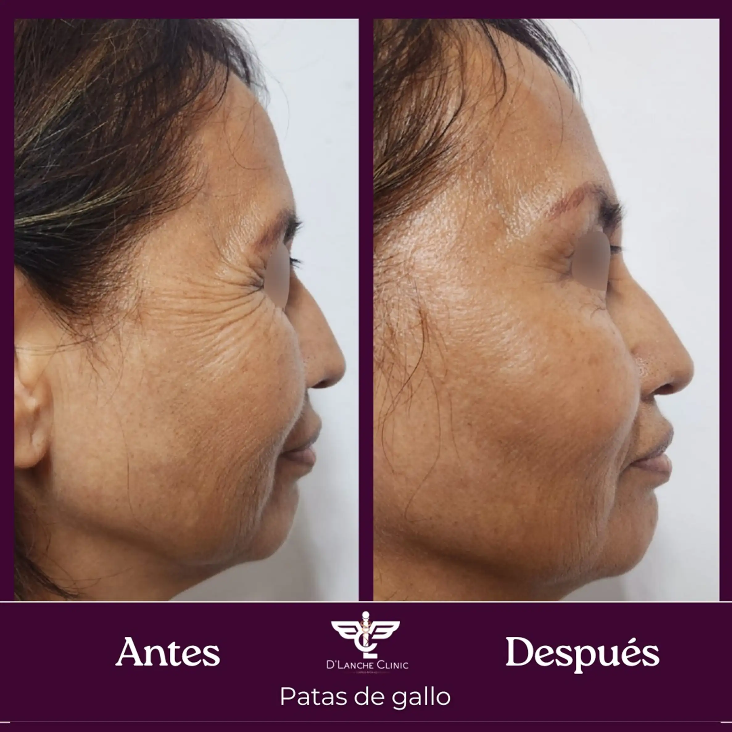 10 Resultados - DLanche Clinic