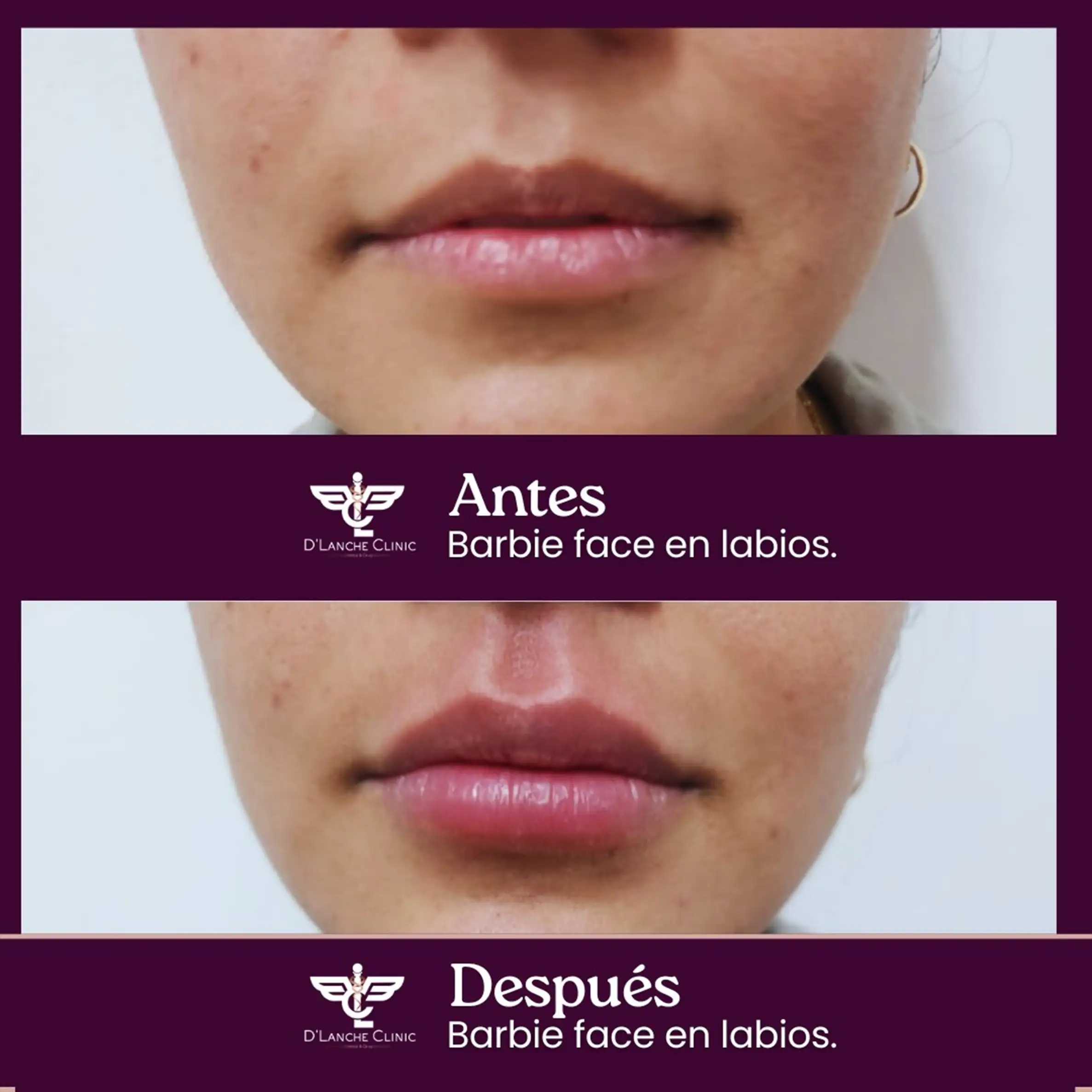 12 Resultados - DLanche Clinic