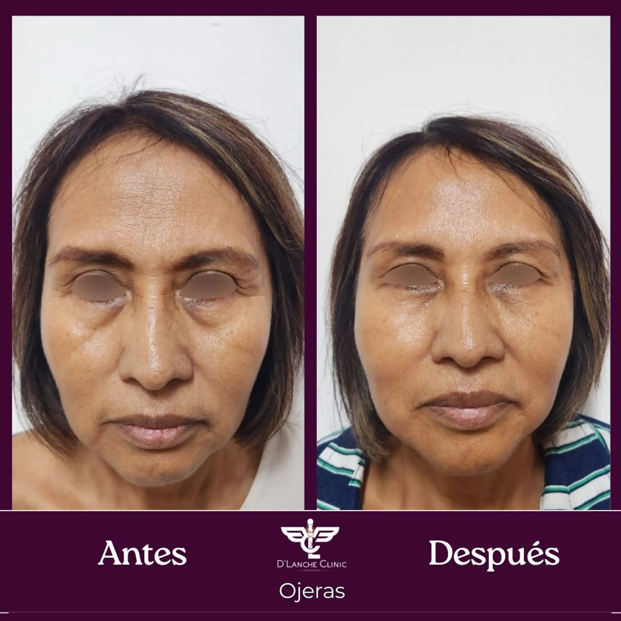 13 Resultados - DLanche Clinic