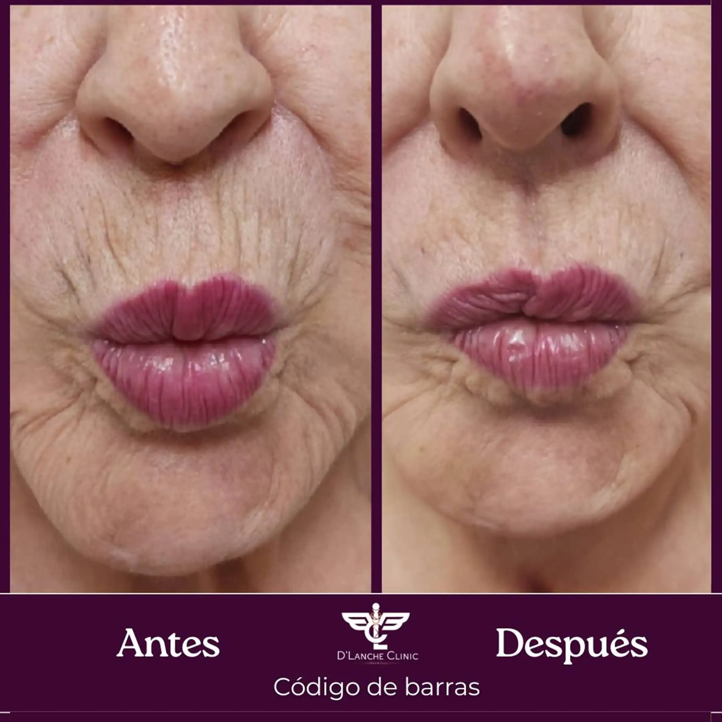 15 Resultados - DLanche Clinic