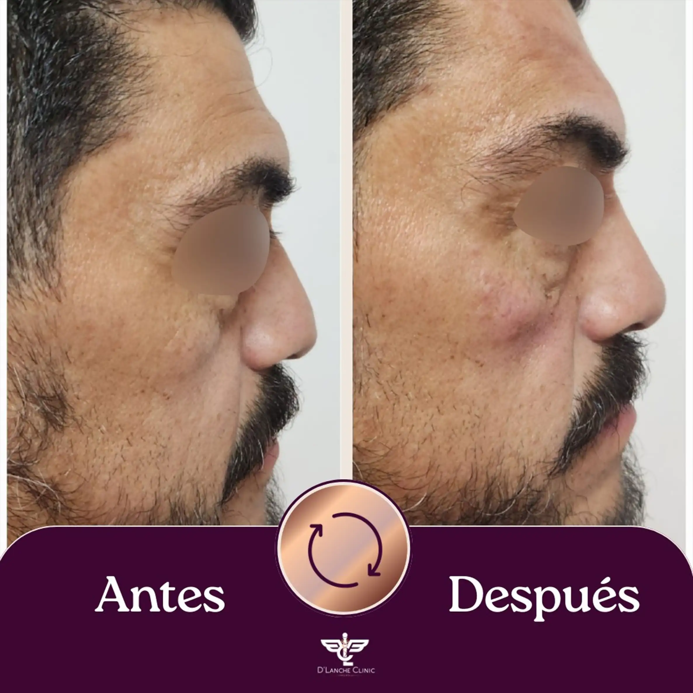 16 Resultados - DLanche Clinic