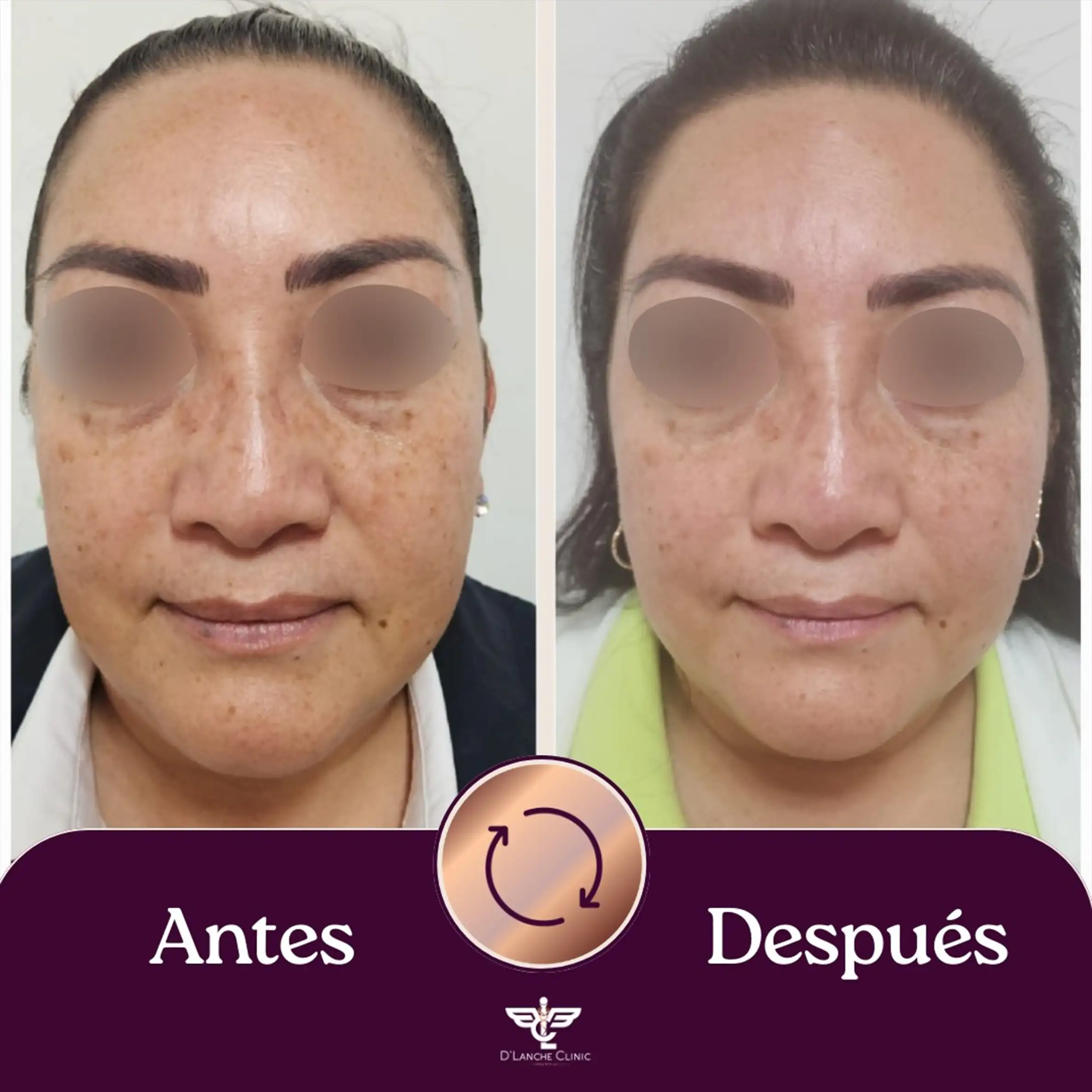 17 Resultados - DLanche Clinic