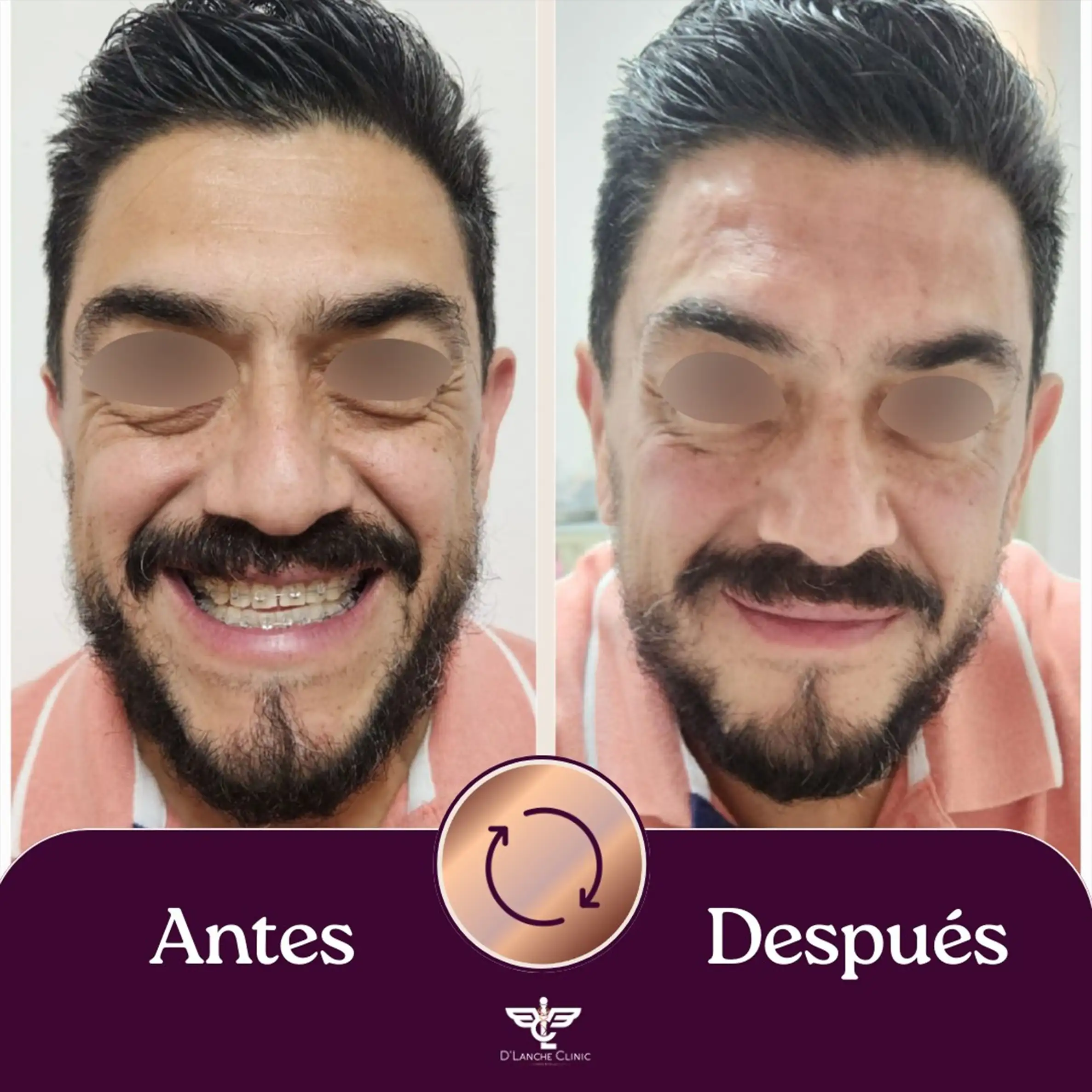 18 Resultados - DLanche Clinic