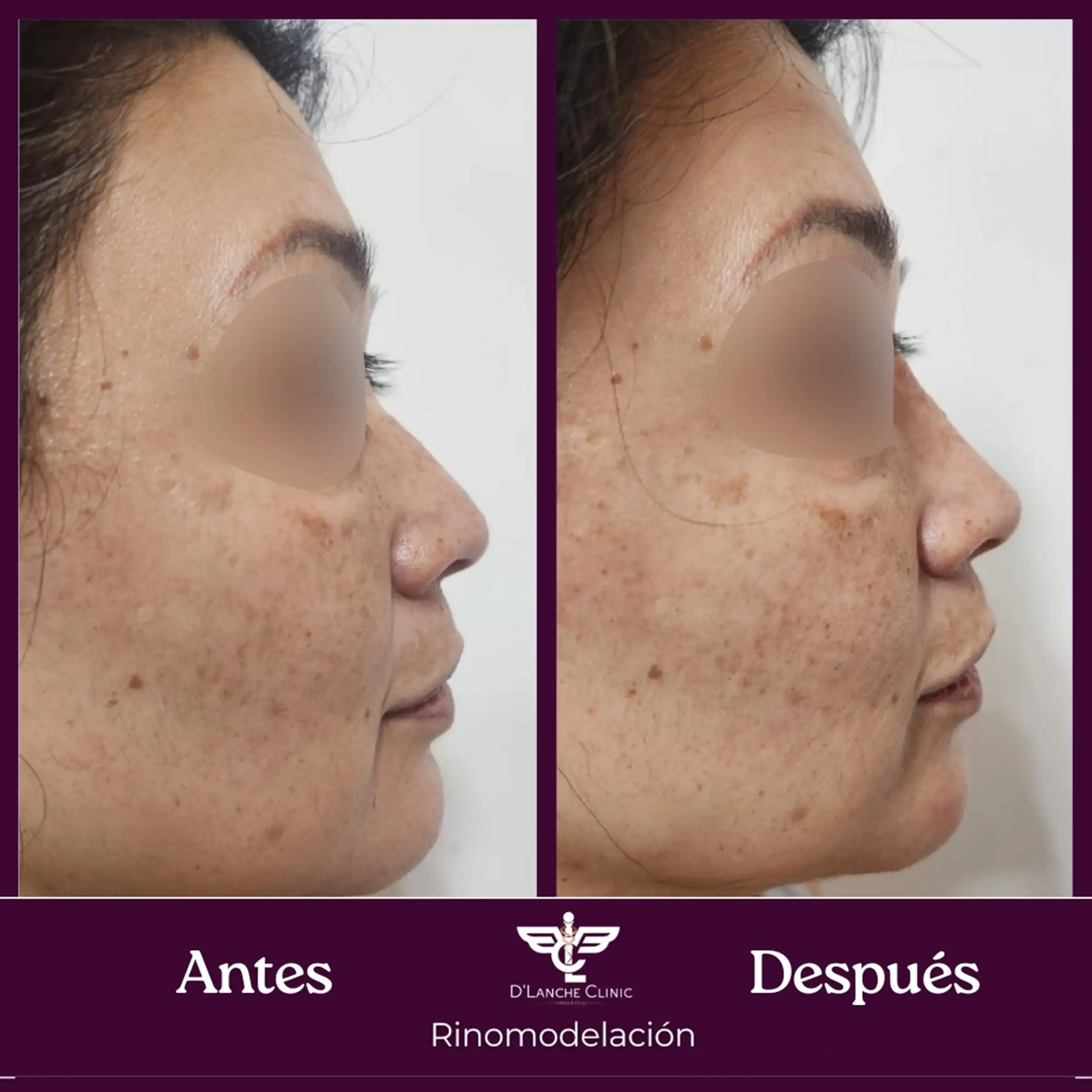 19 Resultados - DLanche Clinic