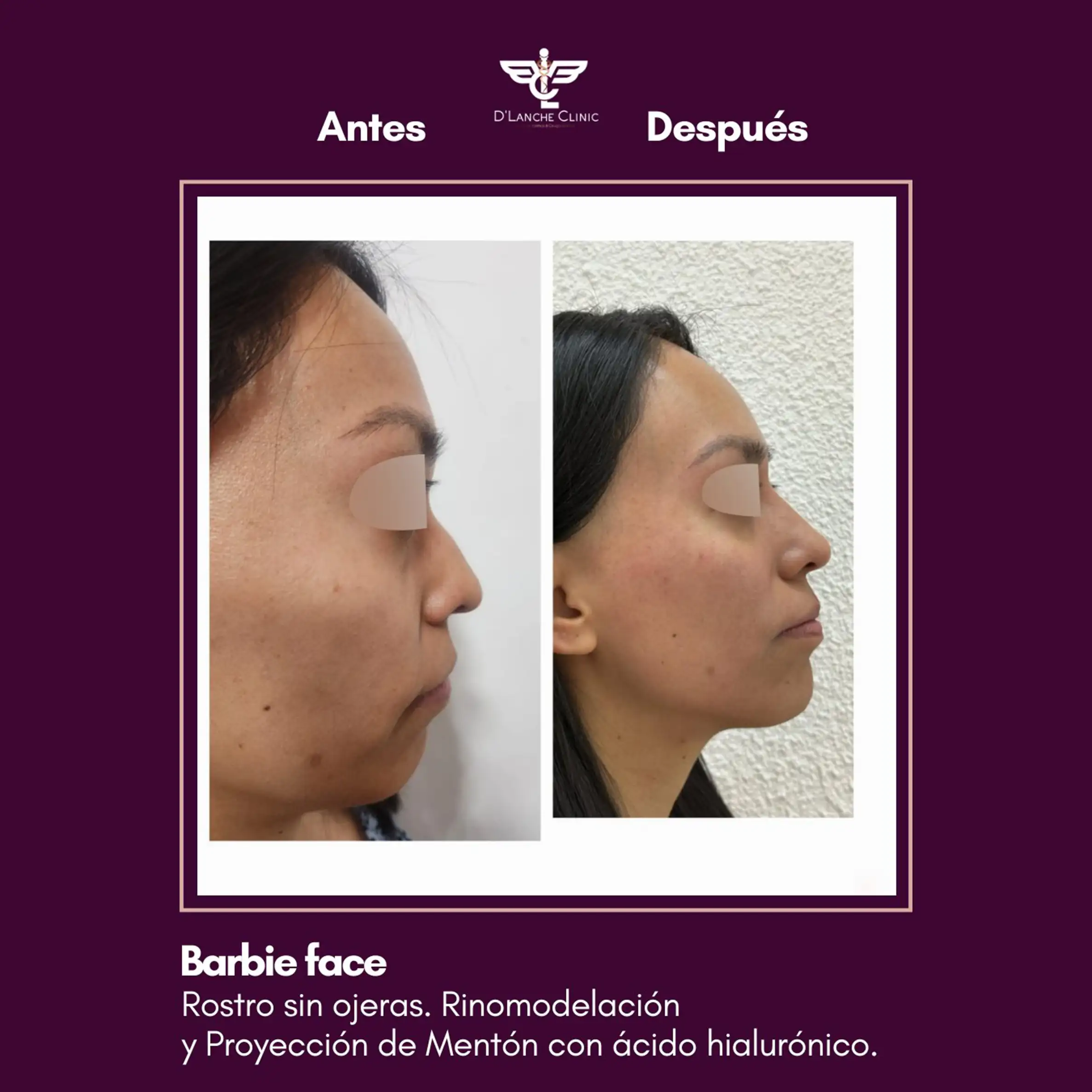 2 Resultados - DLanche Clinic