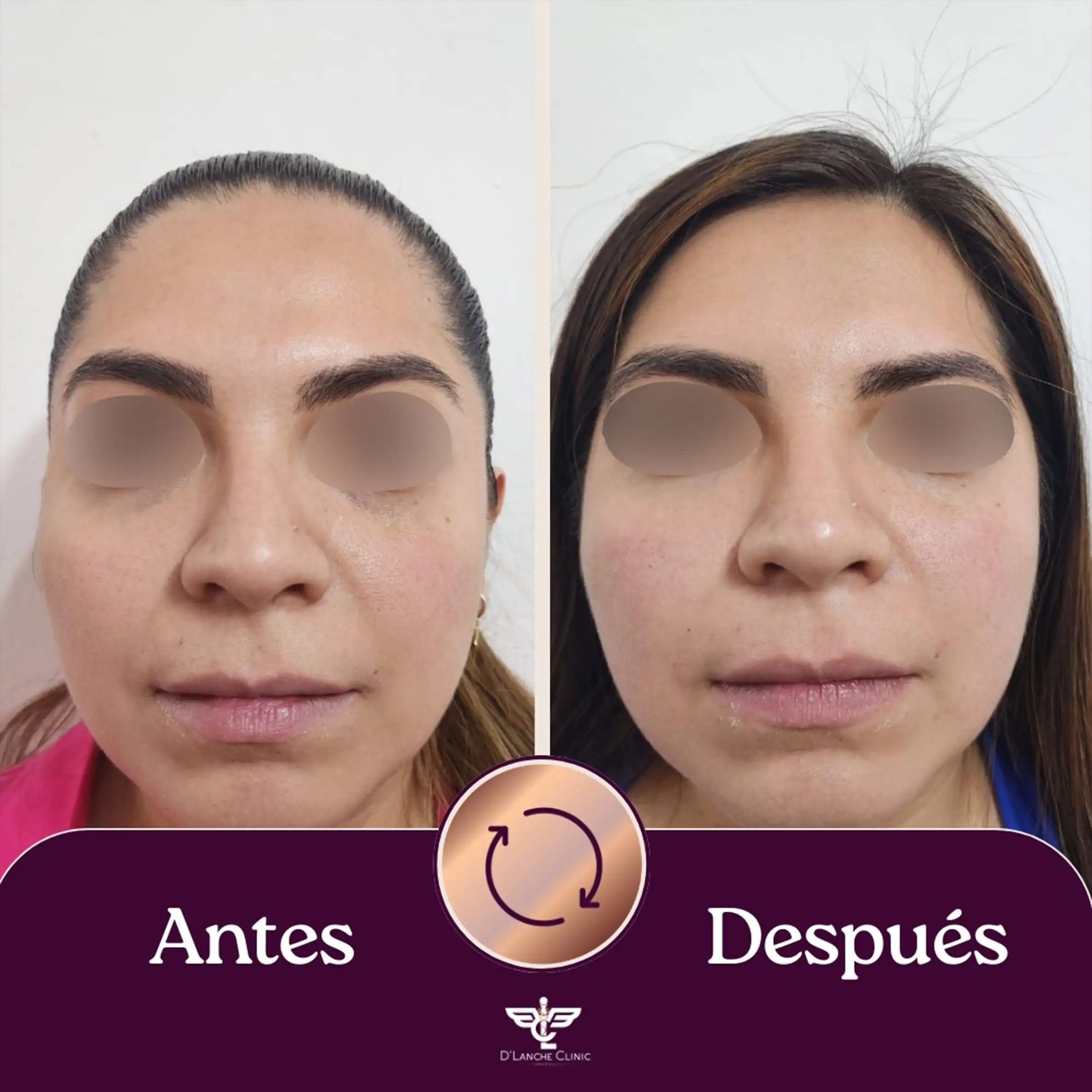 20 Resultados - DLanche Clinic