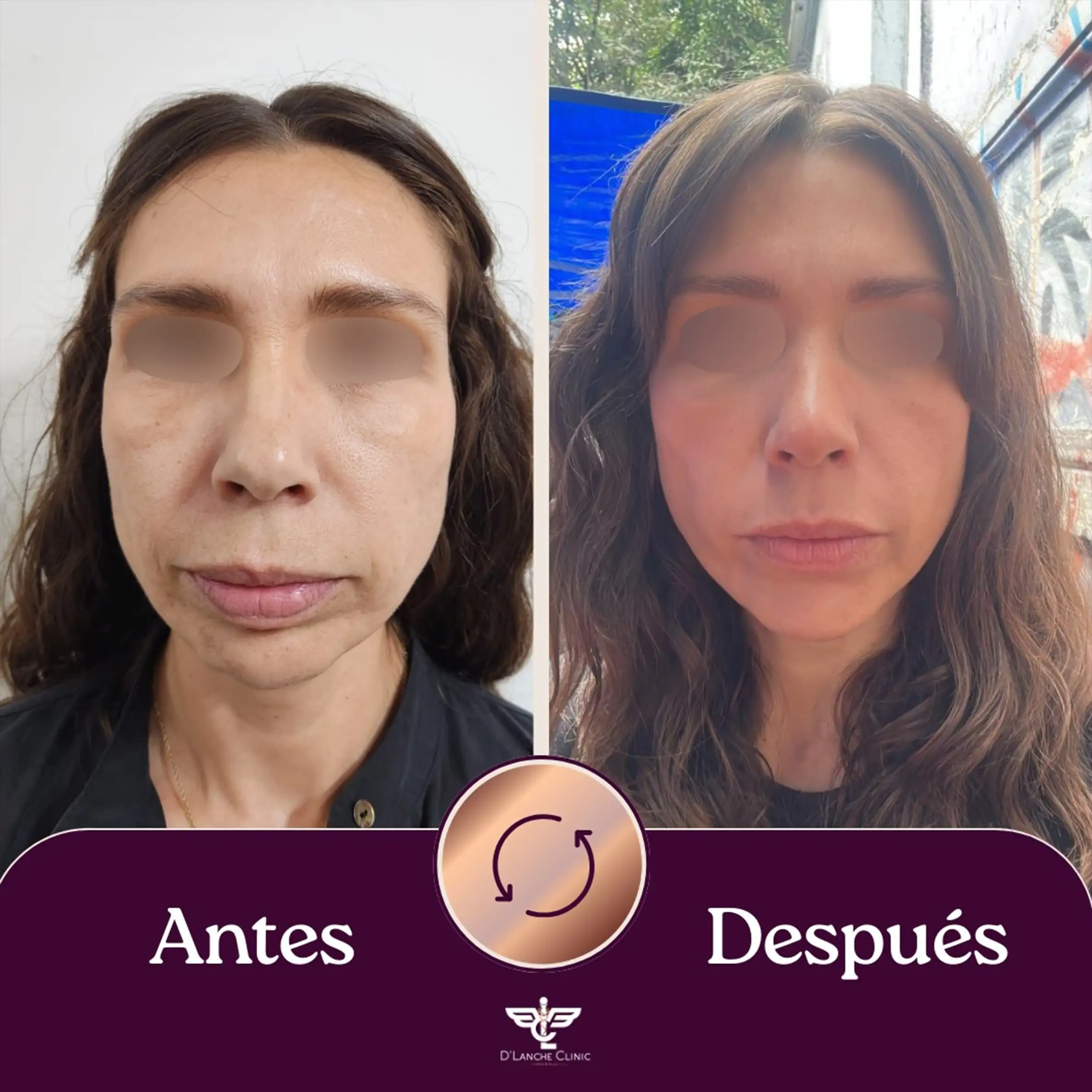 21 Resultados - DLanche Clinic