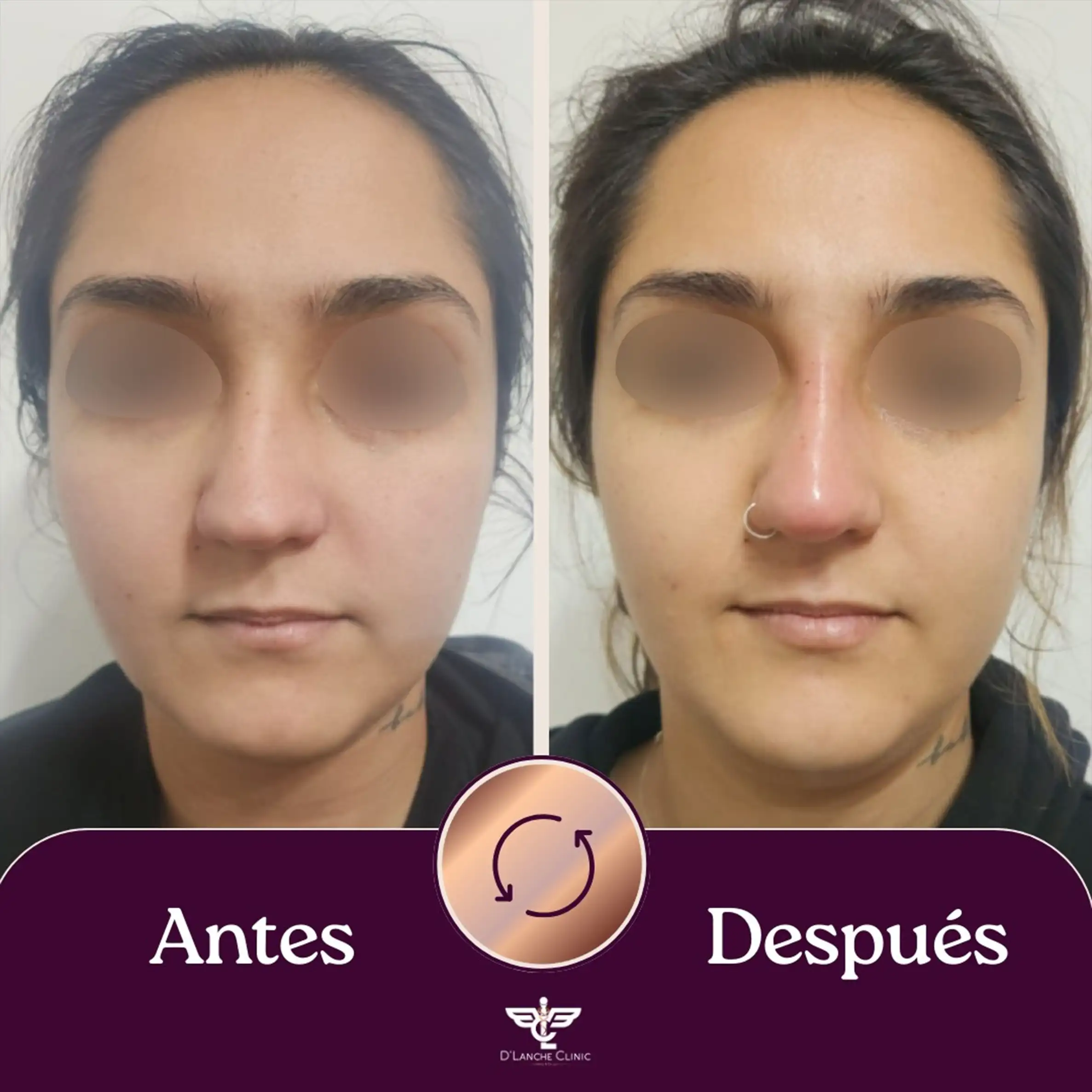 22 Resultados - DLanche Clinic