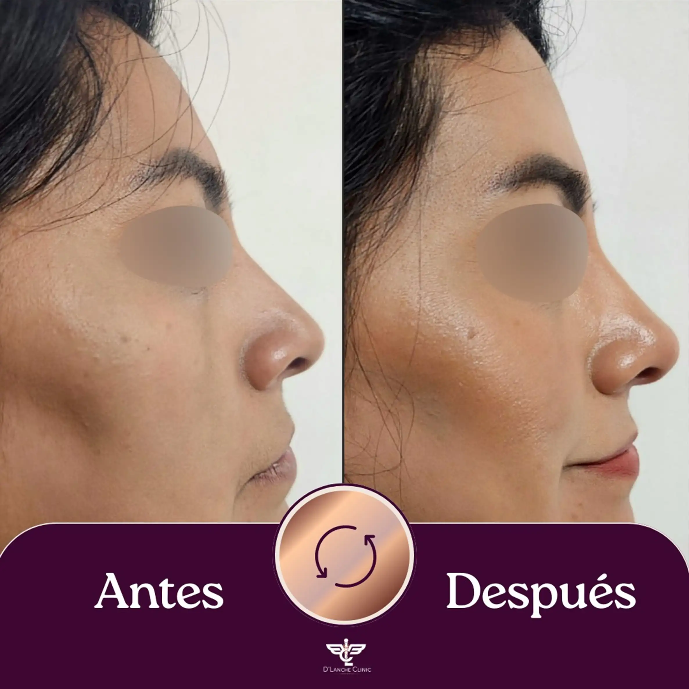 23 Resultados - DLanche Clinic