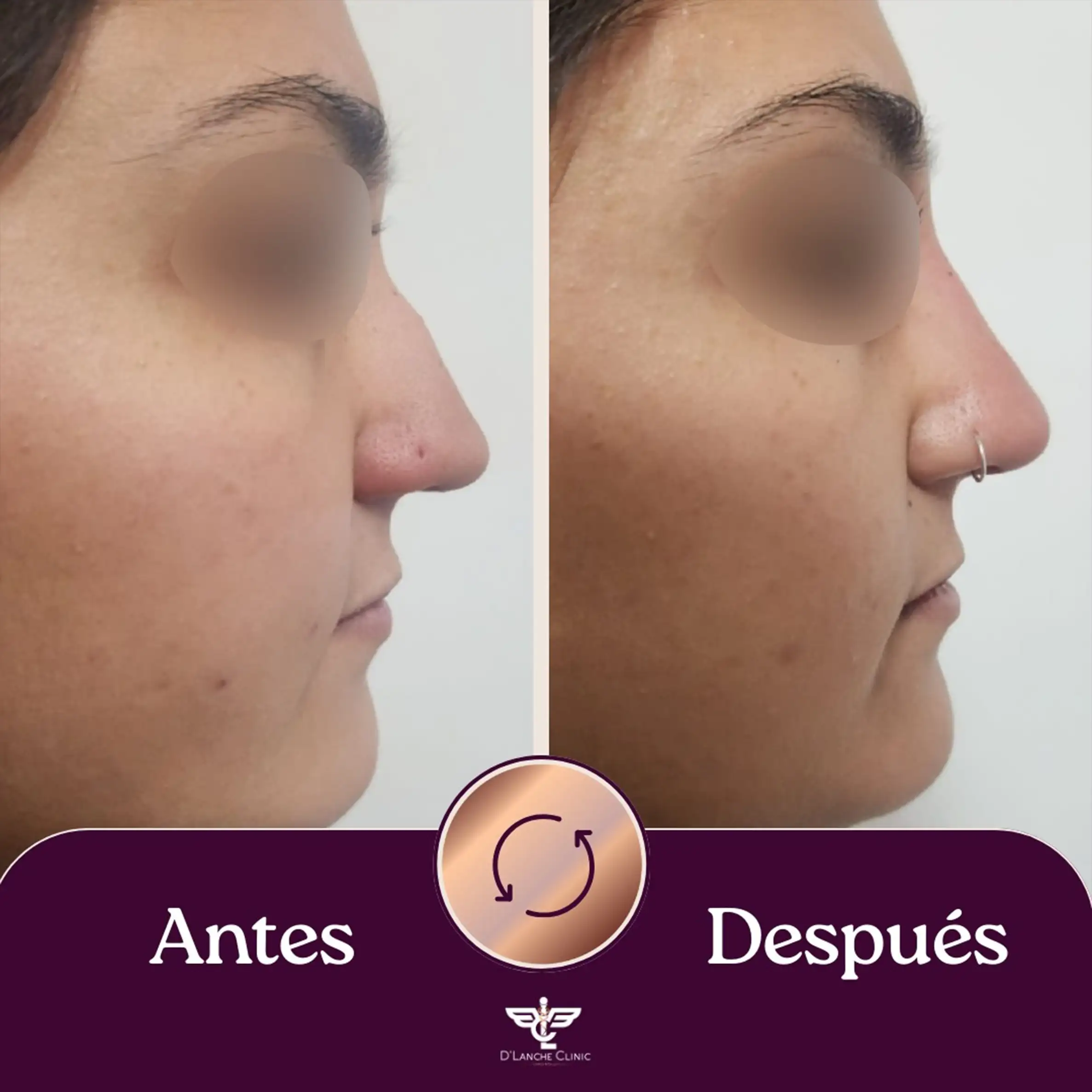 24 Resultados - DLanche Clinic