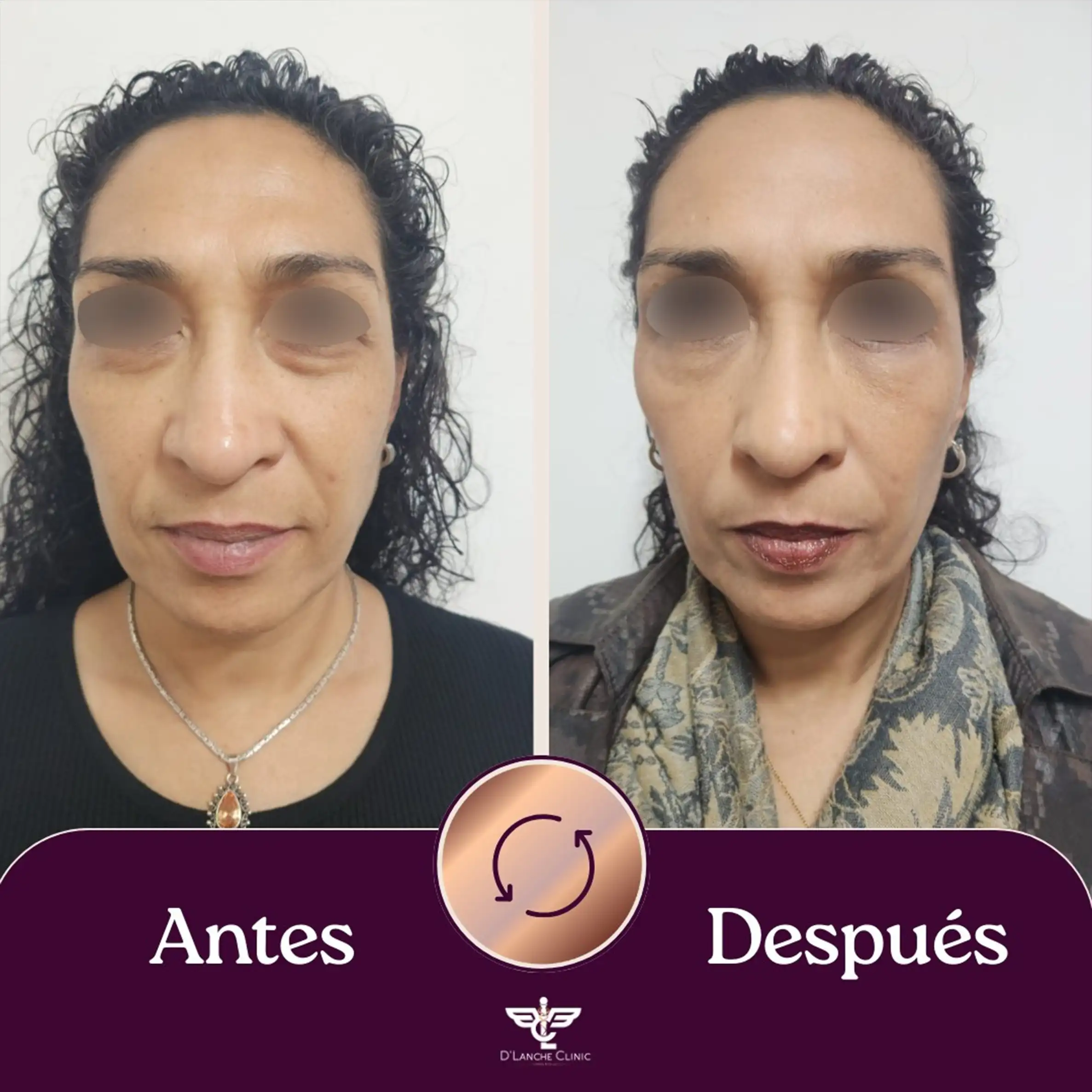 25 Resultados - DLanche Clinic