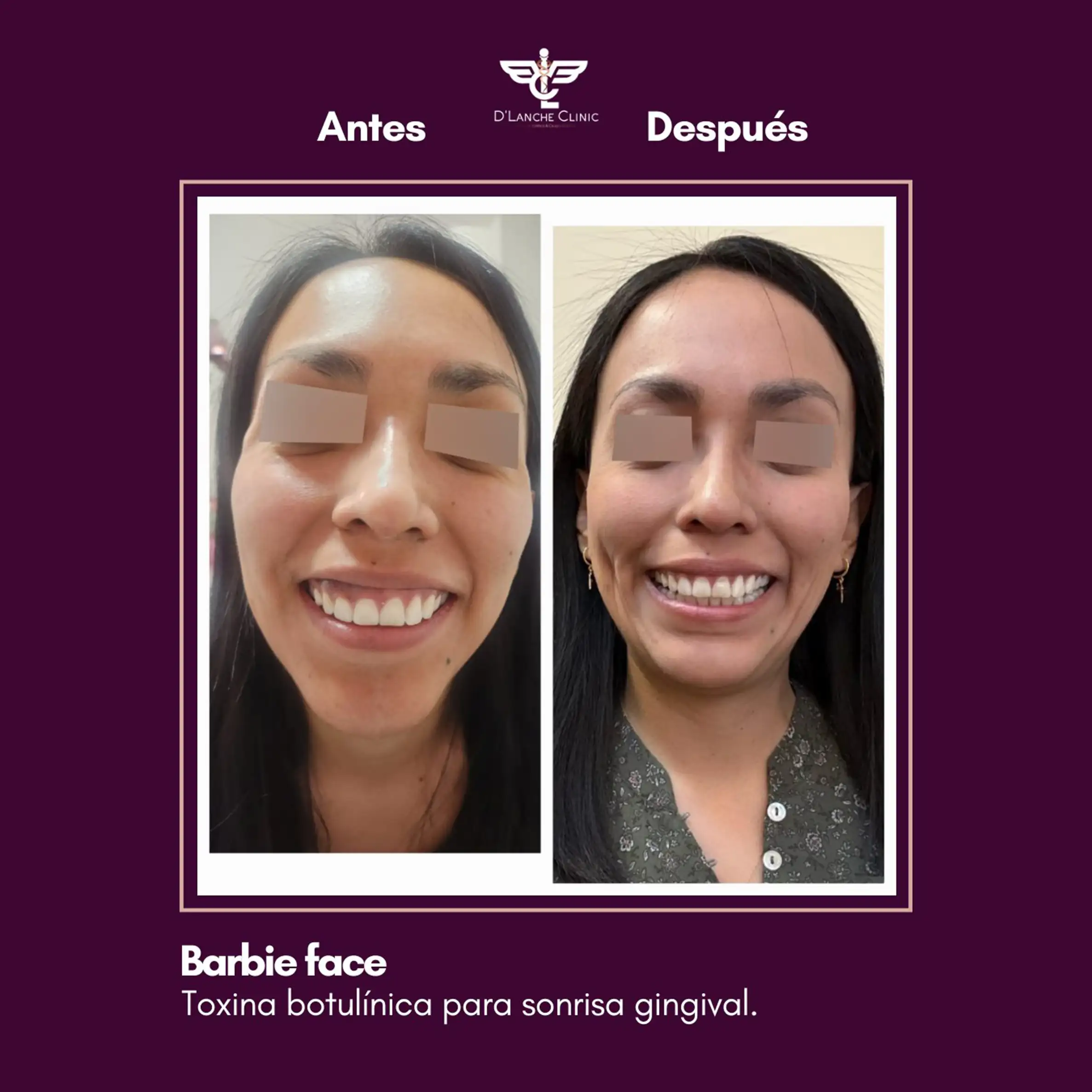 26 Resultados - DLanche Clinic