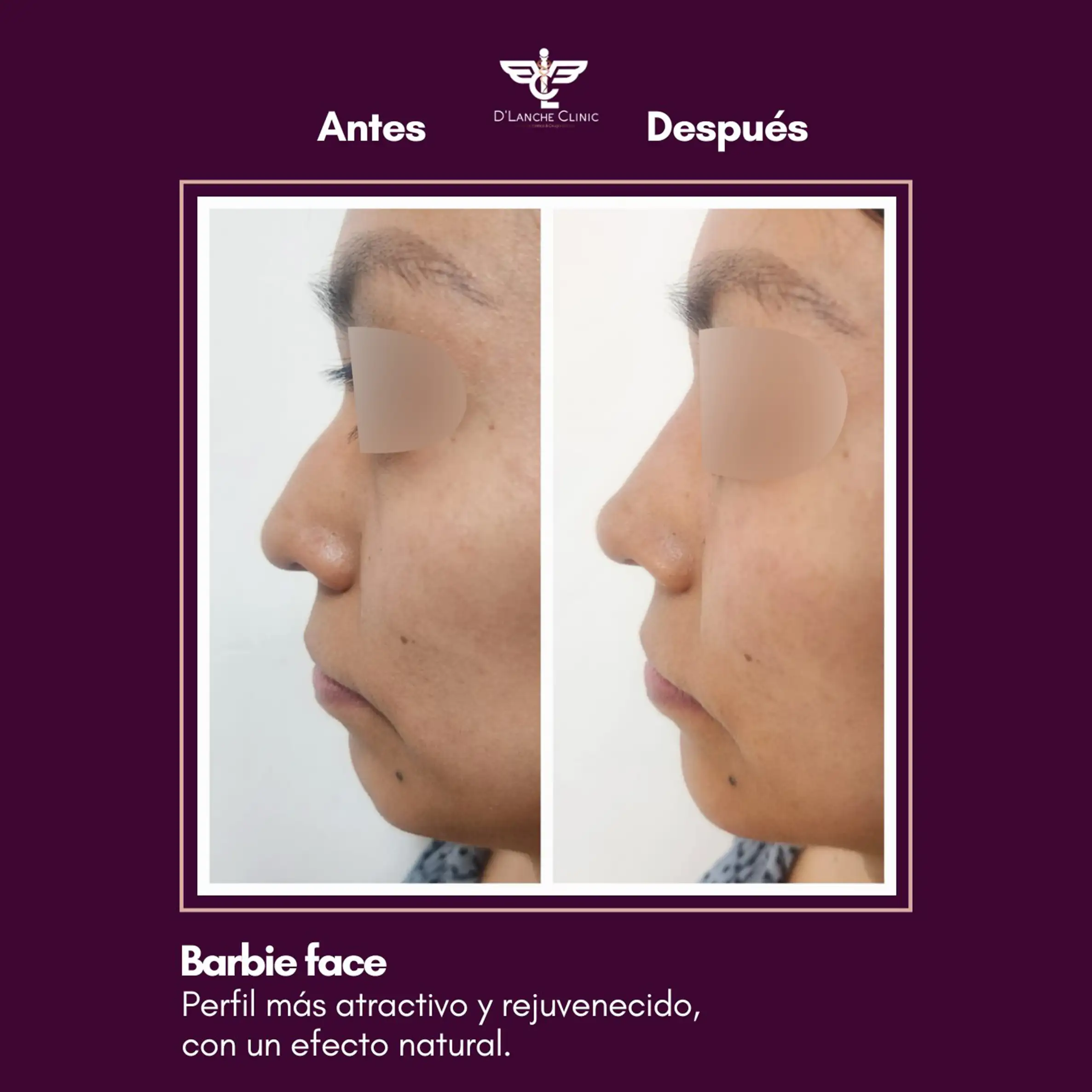 3 Resultados - DLanche Clinic