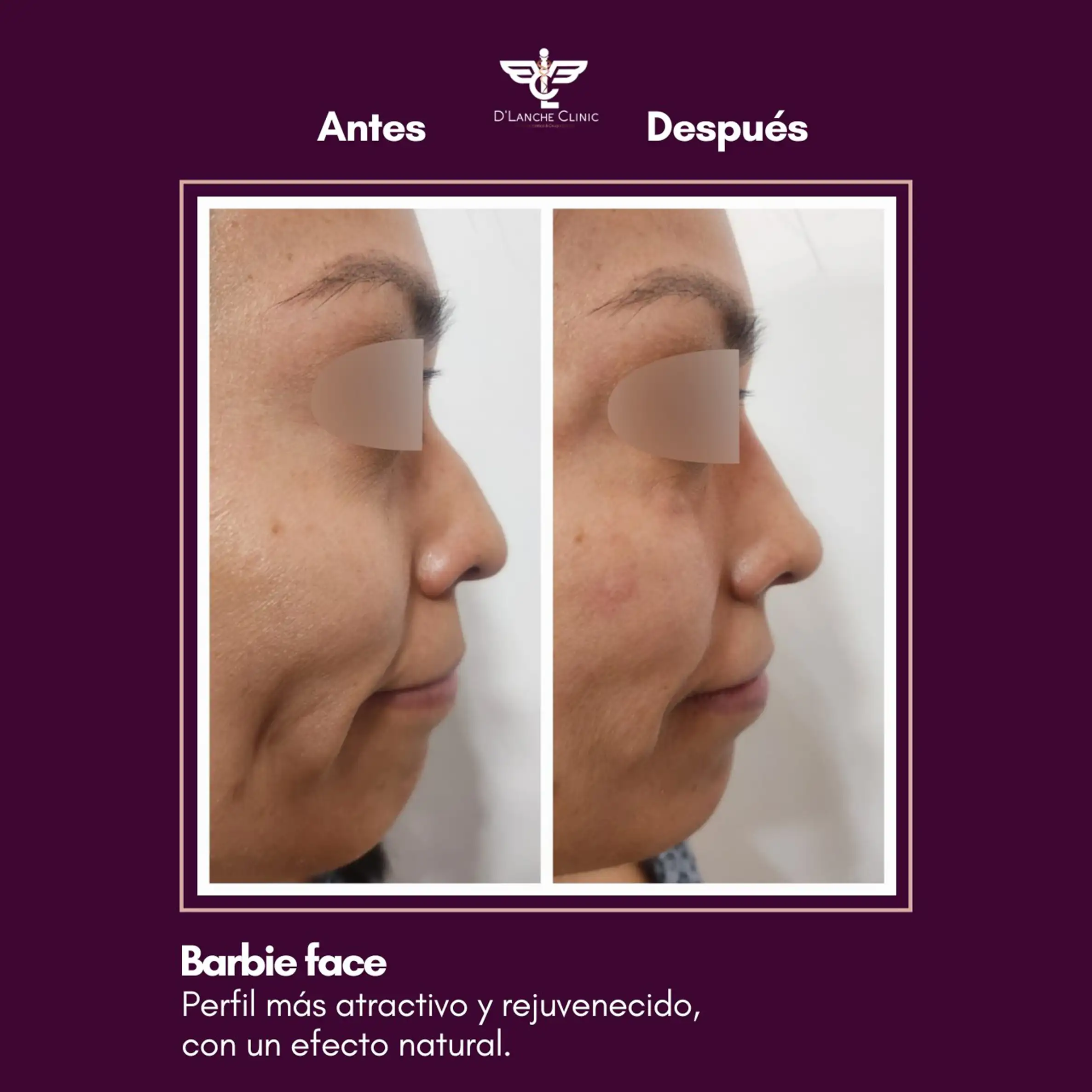 5 Resultados - DLanche Clinic