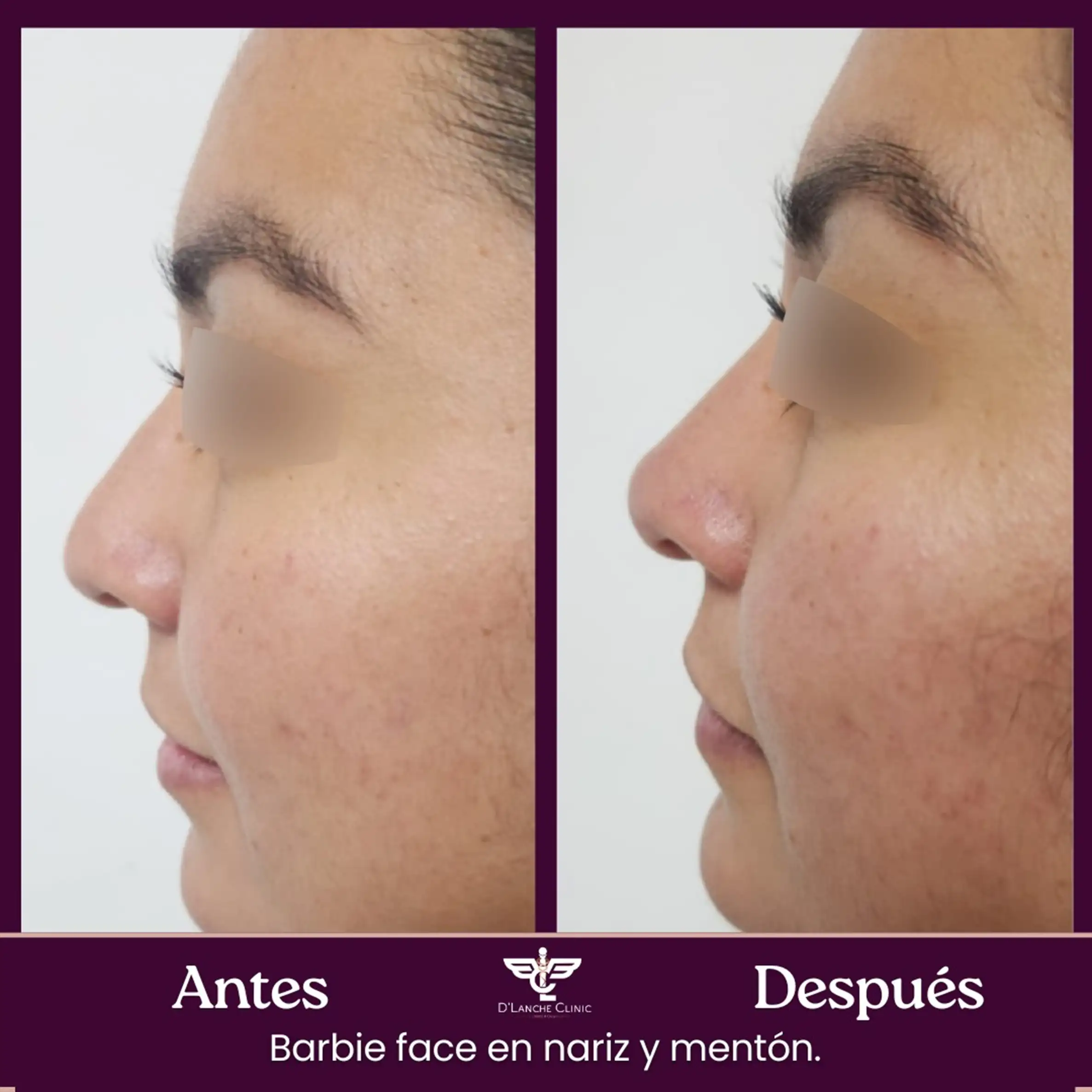 6 Resultados - DLanche Clinic