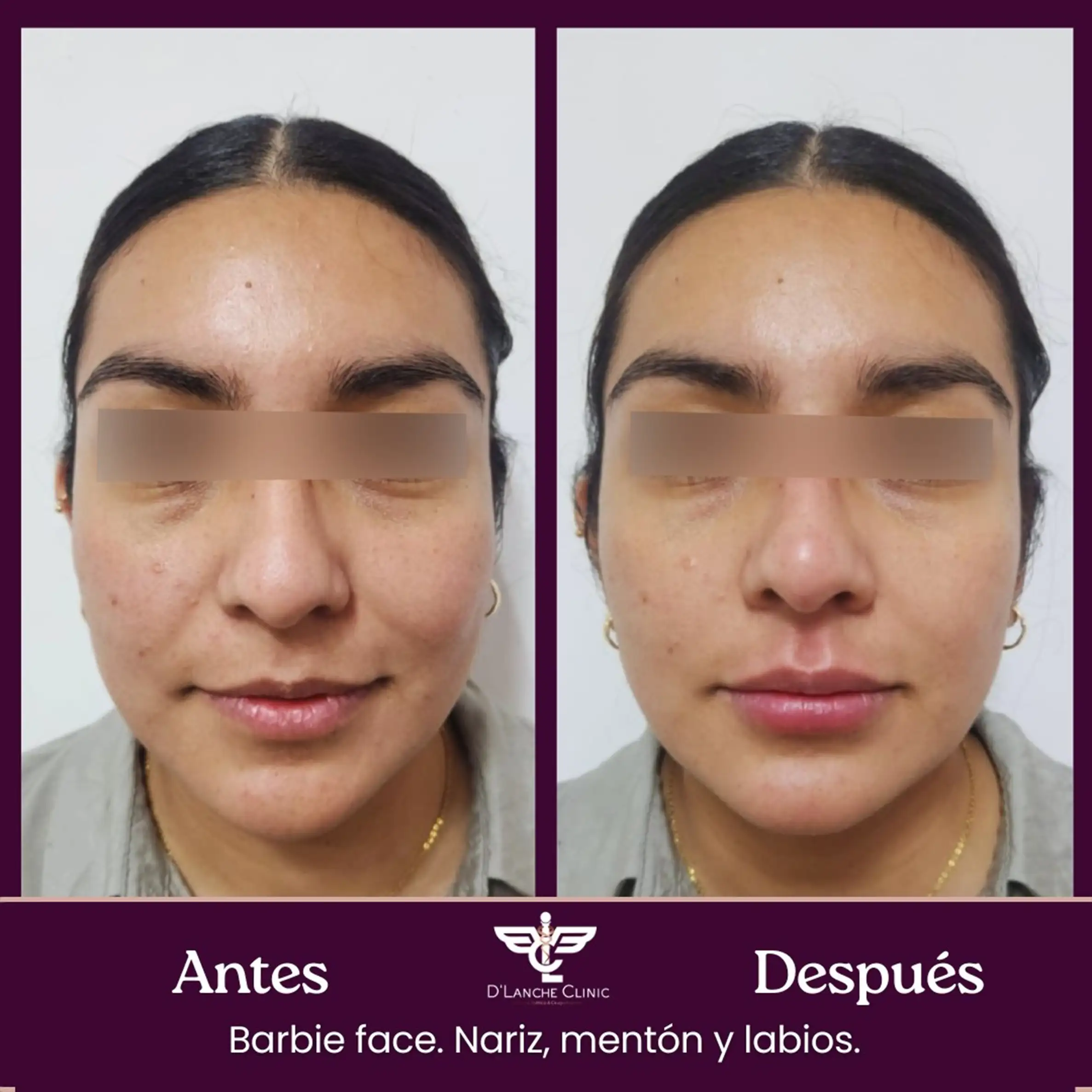 8 Resultados - DLanche Clinic