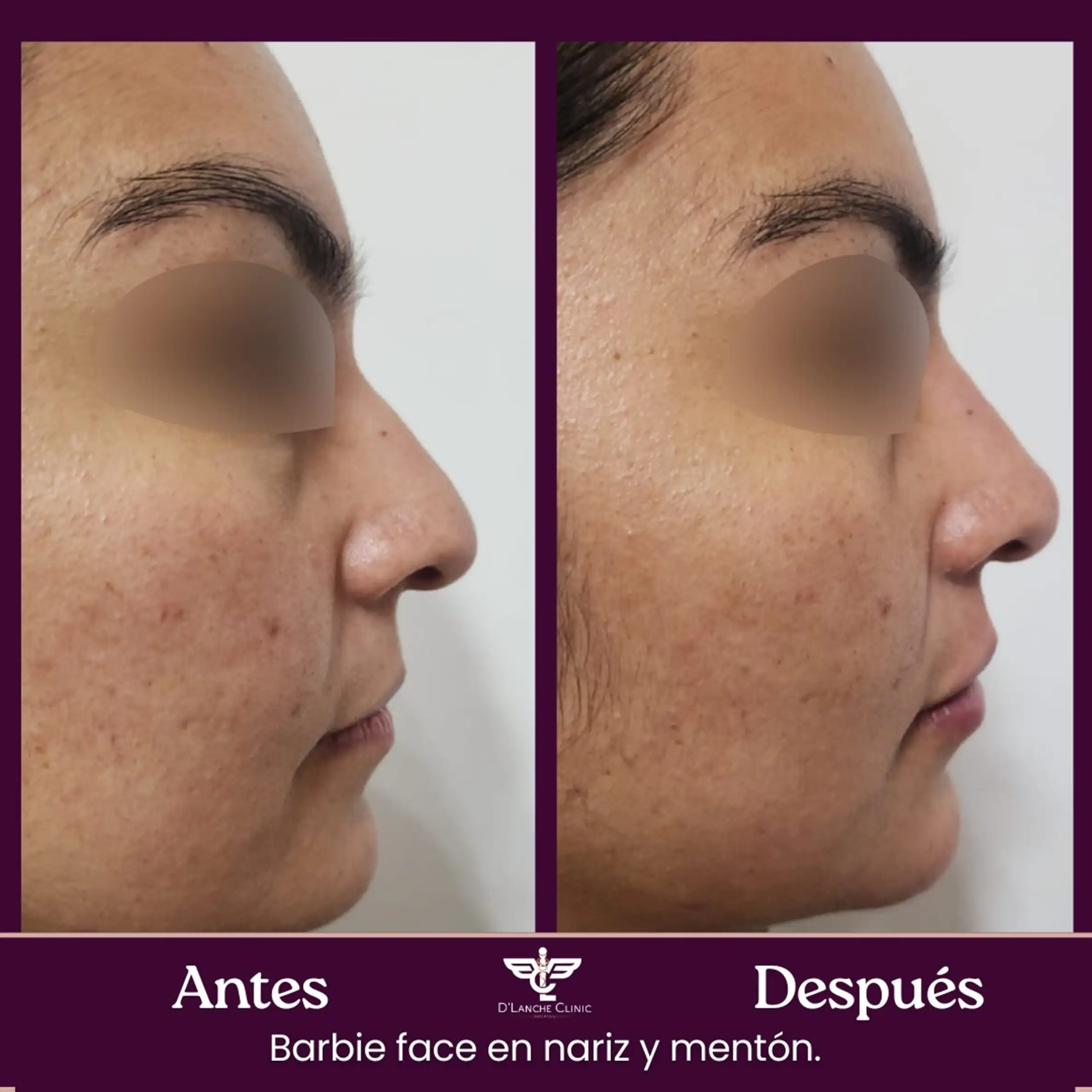 9 Resultados - DLanche Clinic